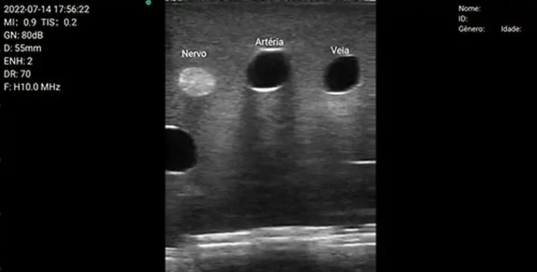 USG Vascular